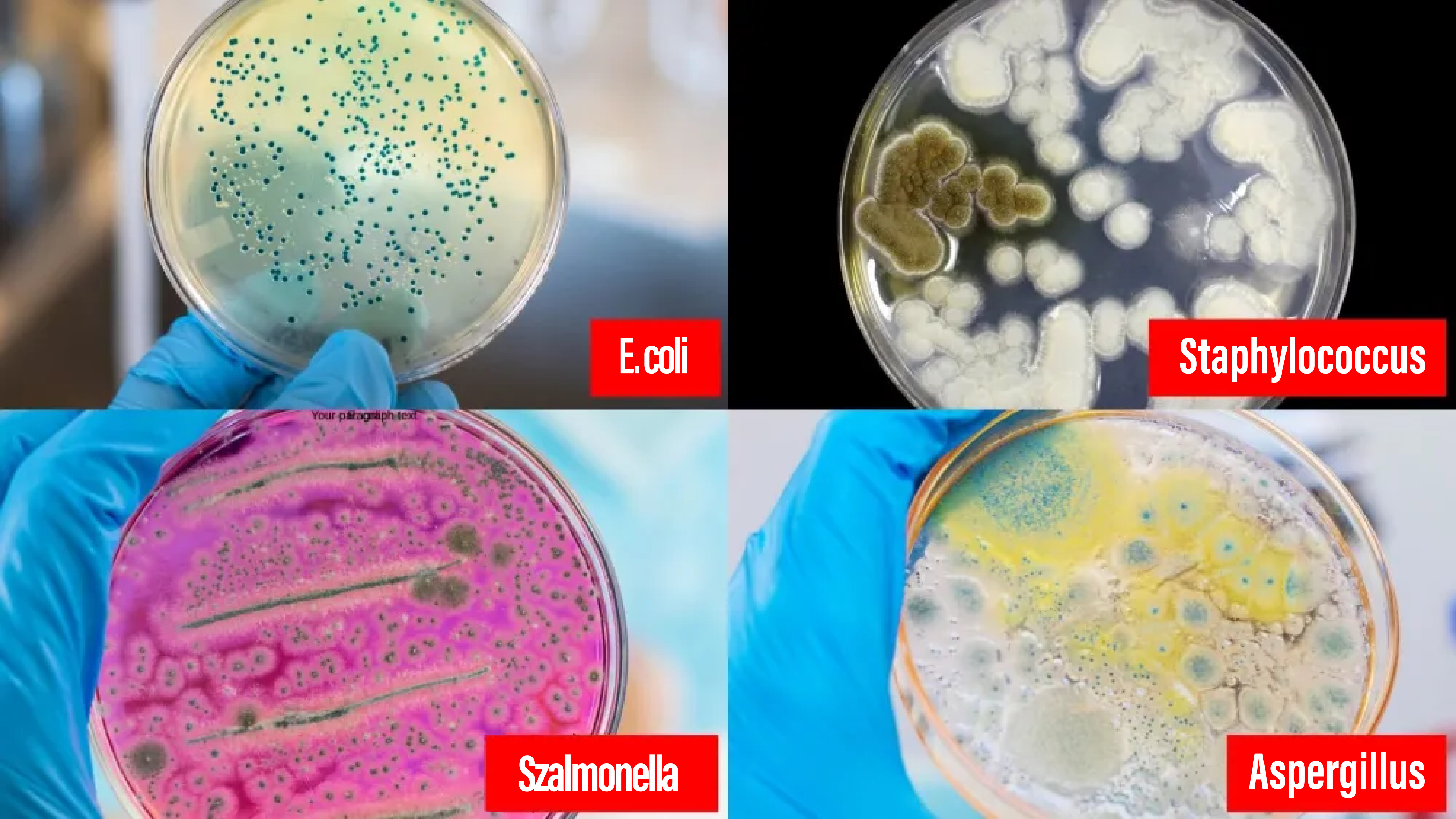 Ecoli salmonella HU C SM